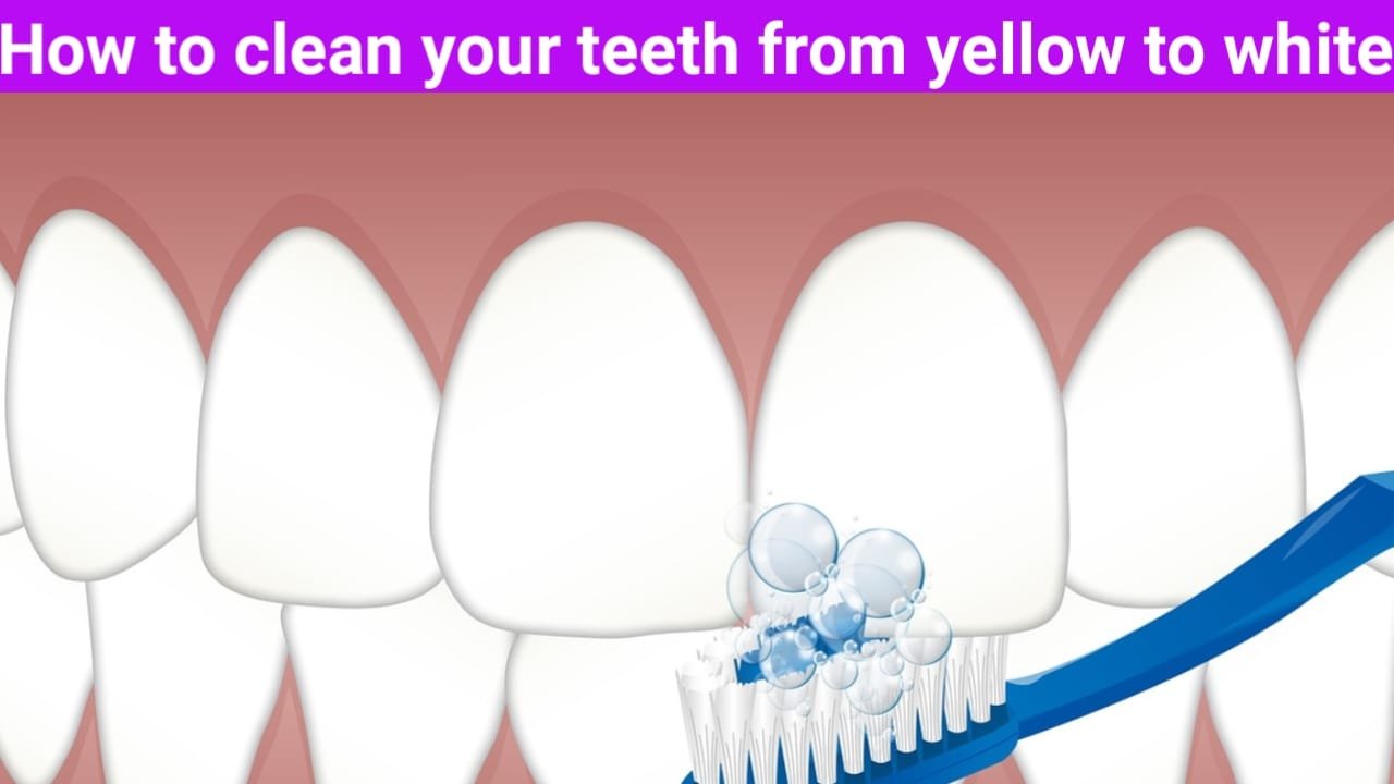 How to clean your teeth from yellow to white